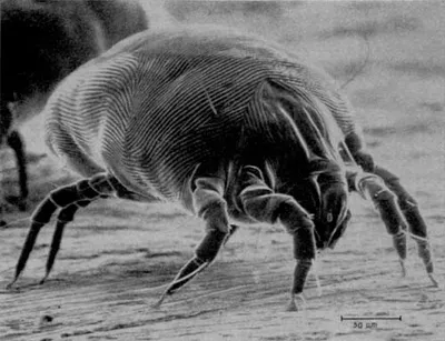 House Dust Mite